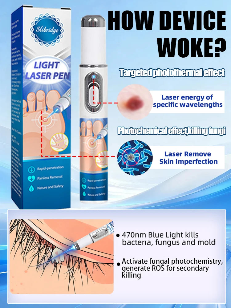 2-in-1 blue light laser pen for painless skin tag, wart, and fungus removal on face, neck, hands, and feet.