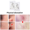 Hot Sale 72Pcs/2Sheets Acne Pimple Patch Clear Gel Invisible Acne Cover Stickers Pimple Remover Beauty Skin Care