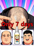 Scalp Massage Roller for Hair Growth - Stimulating Wellness Tool Massage Roller Buy 5 Get 5 Free Tidesmit
