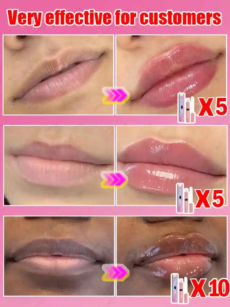 Lip Plumper Serum: Natural Hydrating Lip Care for Fuller Lips Lip Care Tidesmit