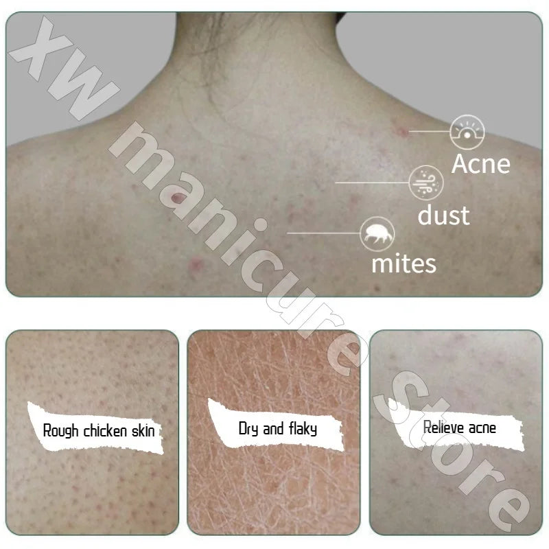 Vaseline Body Lotion Niacinamide Brightens Skin Moisturizes Improves Chicken Skin Improves Dry Body Lotion 100ml/400ml