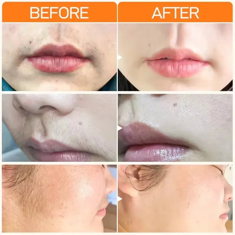 Fast Hair Removal Cream | Painless Depilatory for Face and Body Lip Care Tidesmit