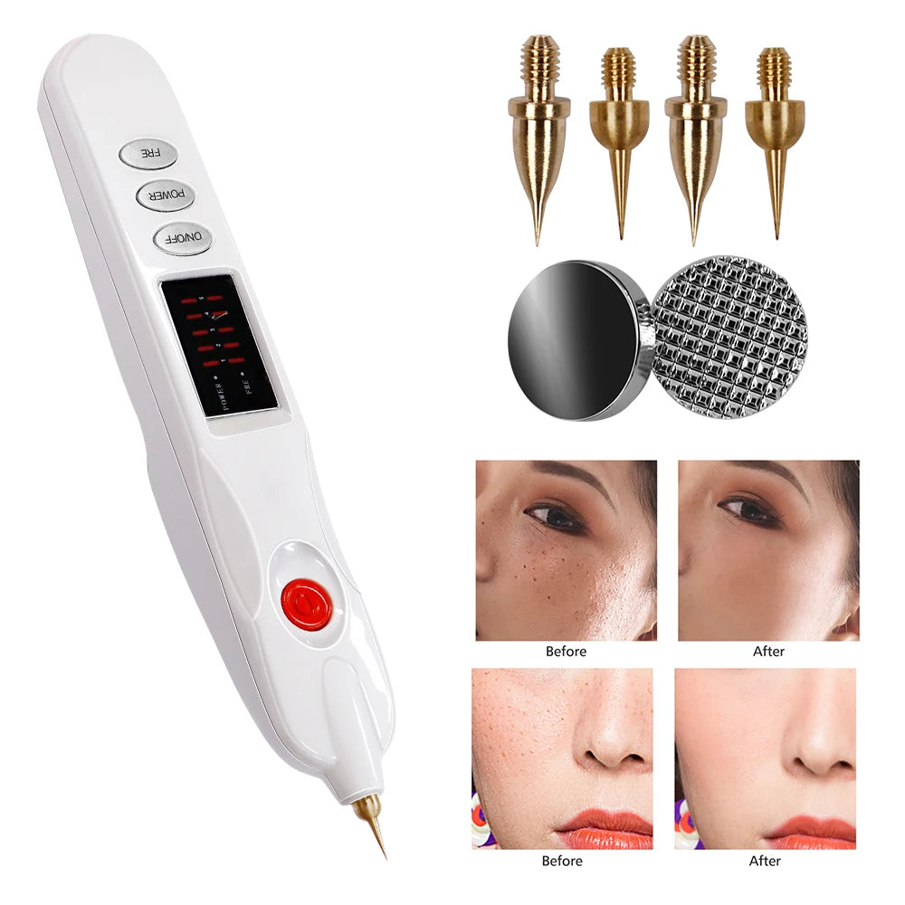 White handheld skin tag removal pen with LED display, replaceable metal needle tips, and skin spot treatment results.