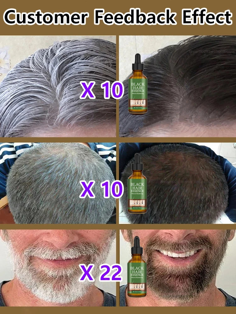 Anti Gray Hair Serum – Natural Scalp Nourishing Darkening Care Lip Care Tidesmit
