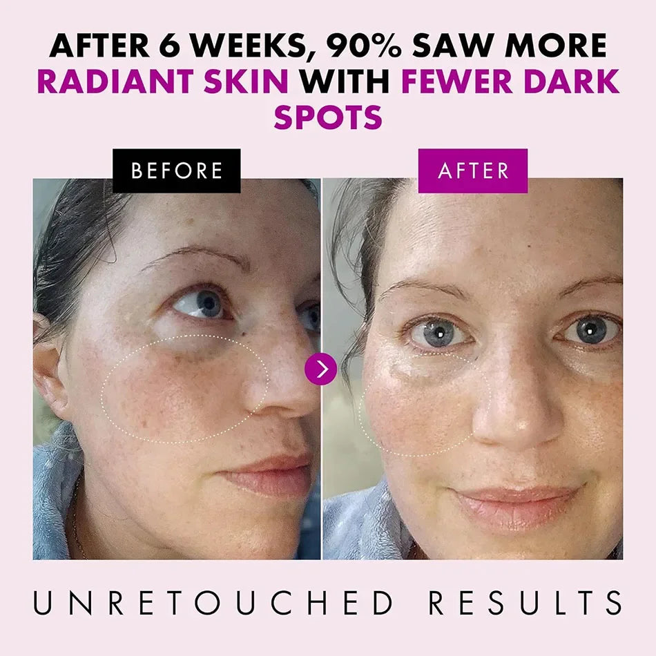 Before and after comparison of a woman's face showing skin improvement after using collagen anti-aging cream.