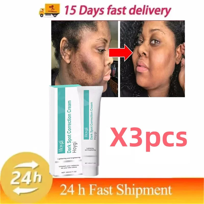 Dark Spot Corrector Cream for Pigmentation & PMU Aftercare | Tidesmit Permanent Makeup Machines 3pc Tidesmit