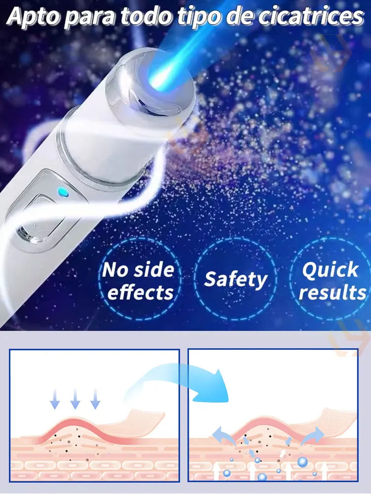 White handheld blue light therapy wand for scar removal, shown with skin treatment diagrams on a blue background.