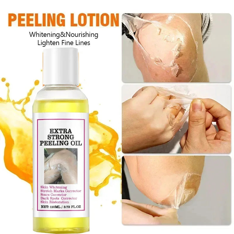 Yellow Peeling Oil for Dark Skin - Salon-Quality 100ml Exfoliating Treatment Scrubs Treatments Tidesmit