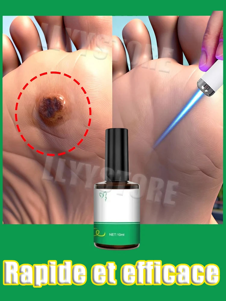 Foot Exfoliating Laser Pen - Professional Home Spa Skin Care Tool Relaxation Treatment Tidesmit