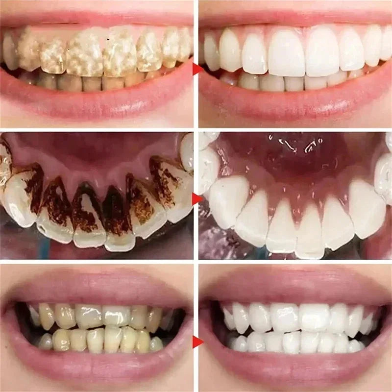 Tidesmit YG52 whitening toothpaste for effective yellow teeth removal and daily oral hygiene care