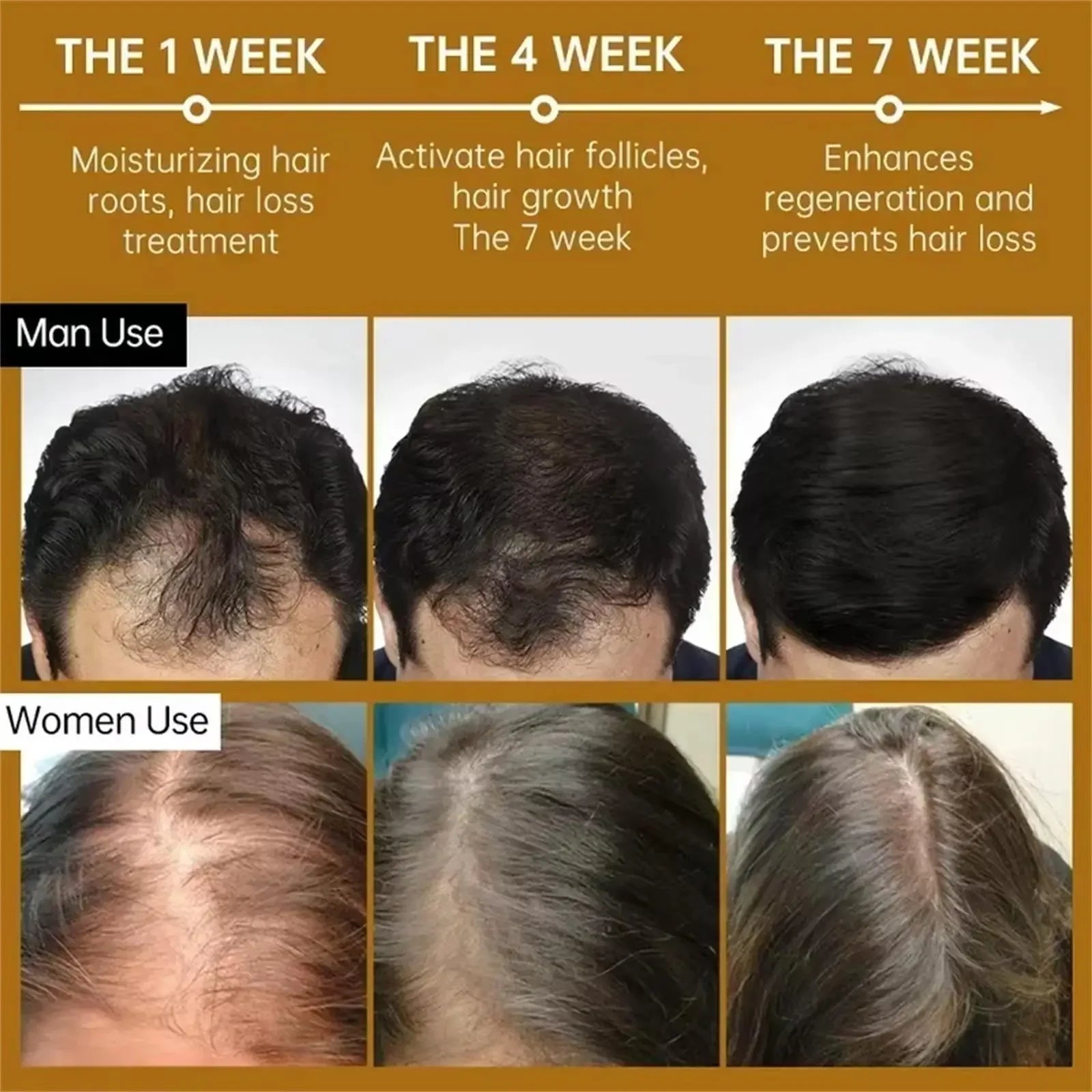 Tidesmit fast hair growth serum capsules for men and women, anti-hair loss scalp treatment for thicker, repaired hair.