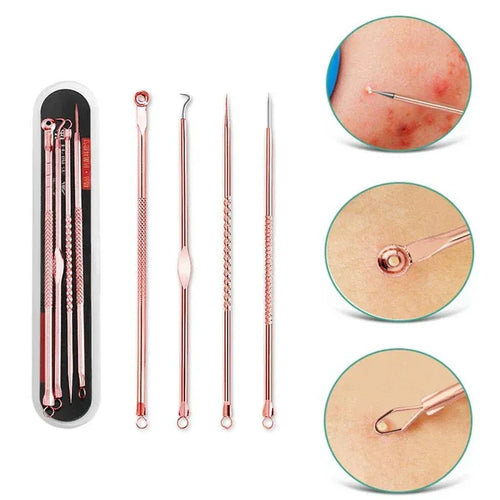 4-piece acne extractor needle tool set with rose-gold metal tips and stems