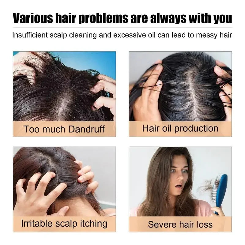 Anti Dandruff Scalp Scrub Treatment for Itch Relief - Tidesmit Scrubs Treatments Tidesmit