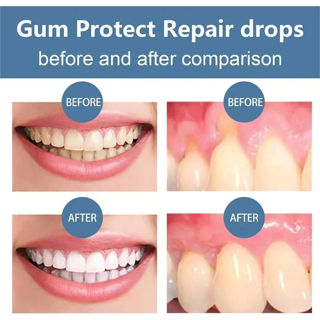 Tidesmit 50ml teeth whitening serum for damage repair, sensitivity relief, and dental cavity prevention.