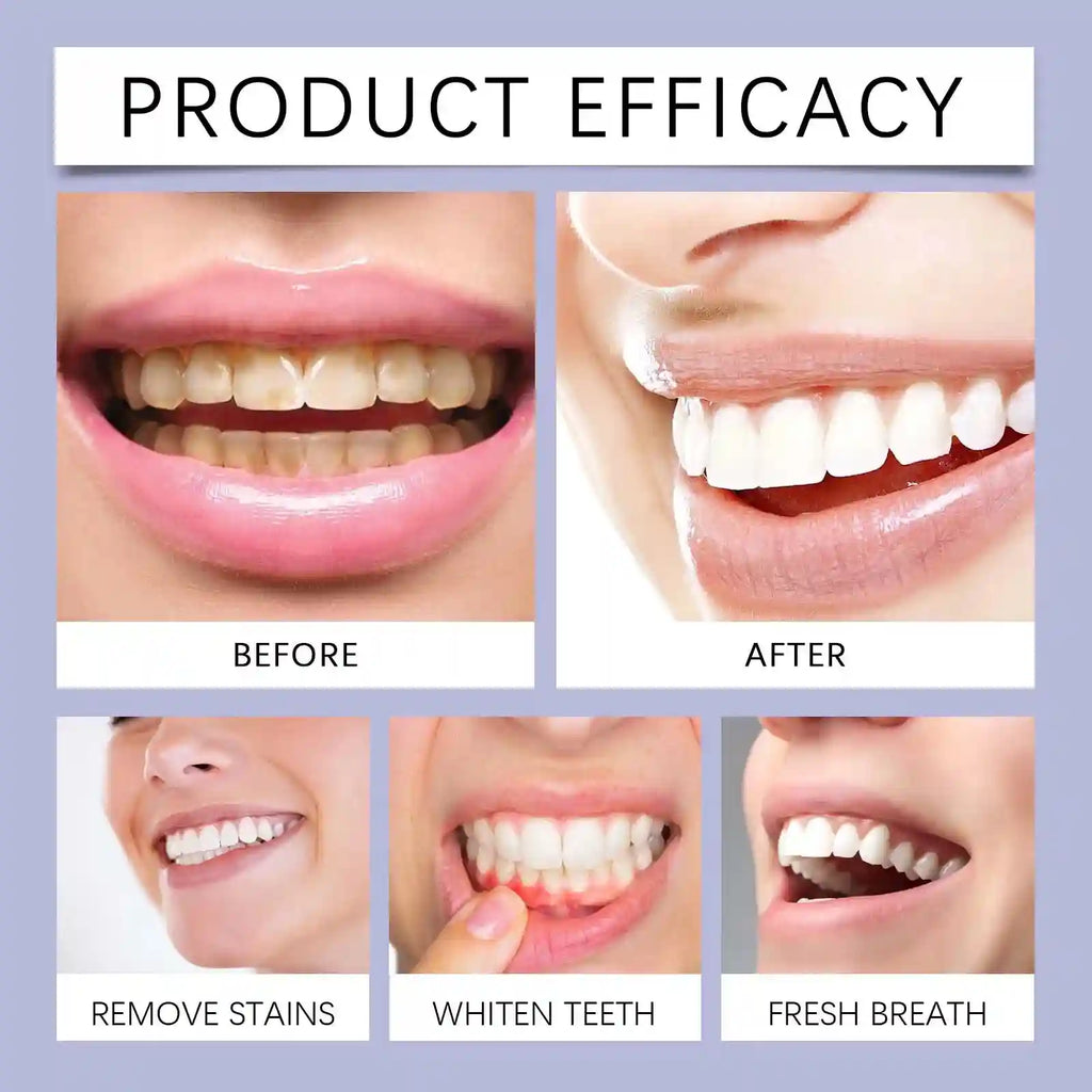 Tidesmit natural teeth whitening kit for deep cleaning and fresh breath daily oral care.