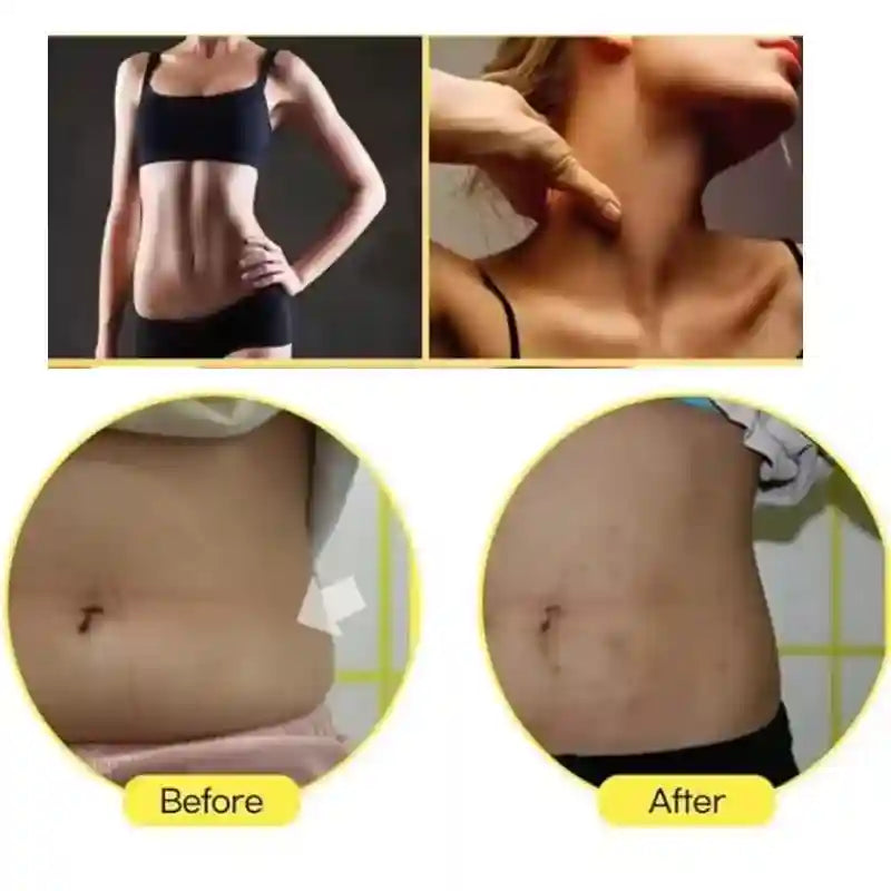 10ml lemon lipolytic ampoule serum for face and body slimming, showing before and after belly fat reduction results.