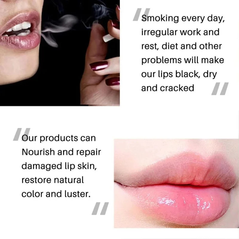 Pink Lip Lightening Cream - Moisturizing Dark Spot Treatment (1-5pc) Lip Care Tidesmit