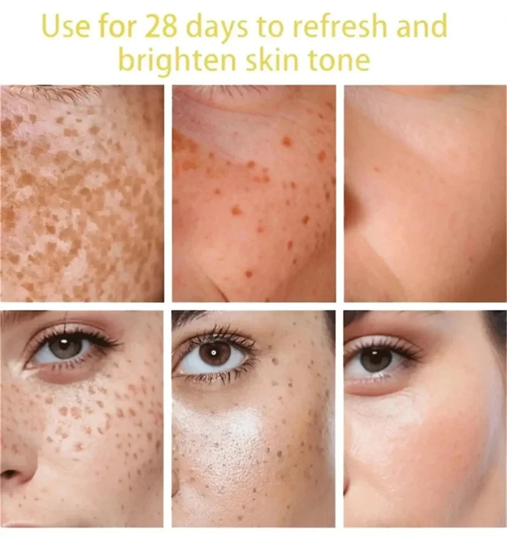 Before and after comparison of skin showing reduction in dark spots, freckles, and pigmentation after 28 days of use.