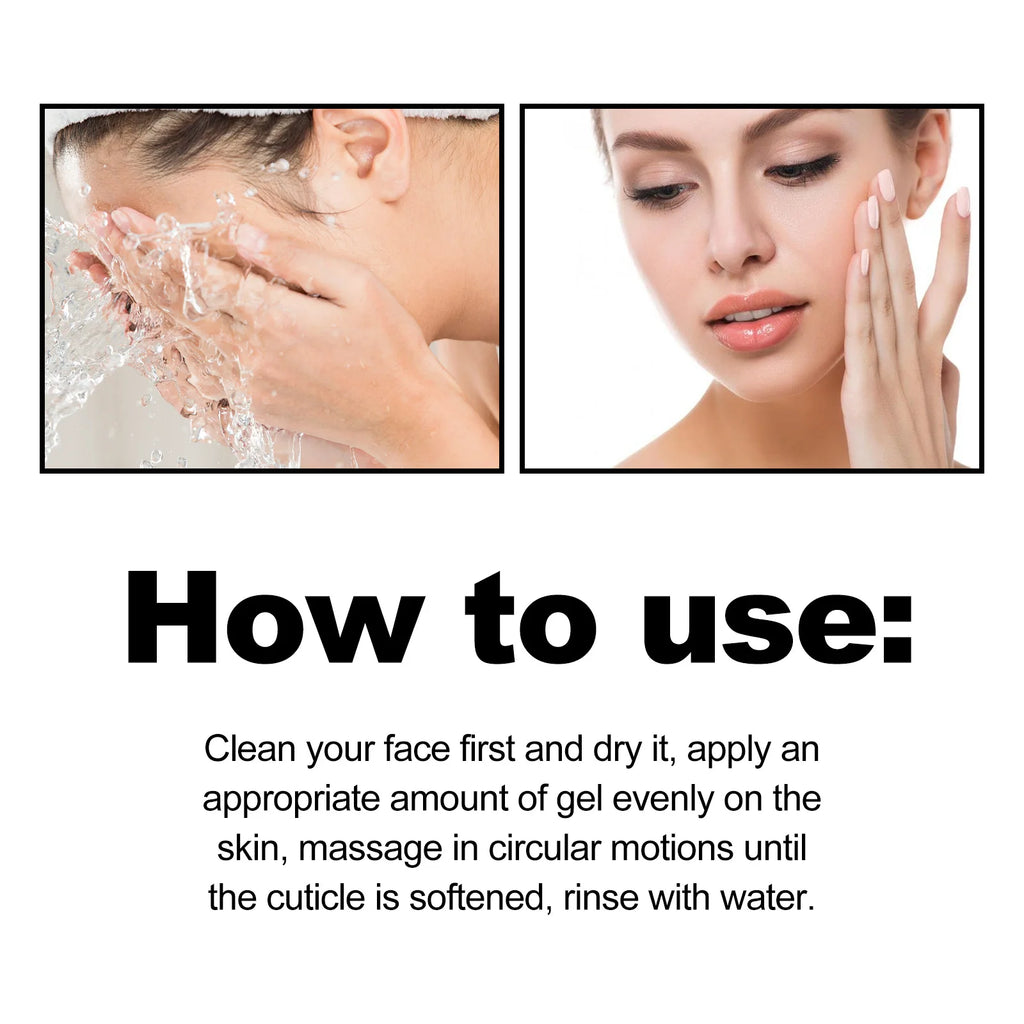 Exfoliating Peeling Gel for Acne and Blackheads - 50g Gentle Formula Scrubs Treatments Tidesmit
