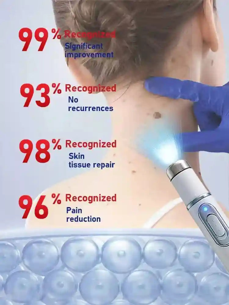 Blue Light Skin Massage Roller - Painless Electric Wellness Tool Massage Roller Tidesmit