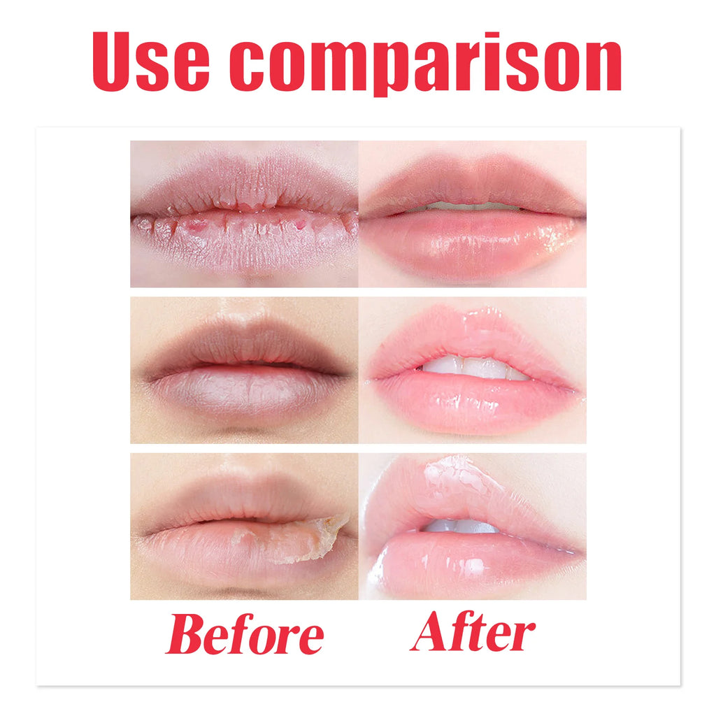 Lip Sleeping Mask – Nourishing Exfoliating Treatment for Chapped Lips Lip Care Tidesmit