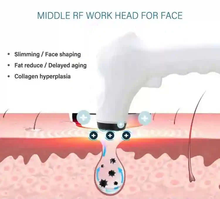 RF Face Lifting Machine for Skin Tightening and Wrinkle Reduction Eye Massage Instrument Tidesmit