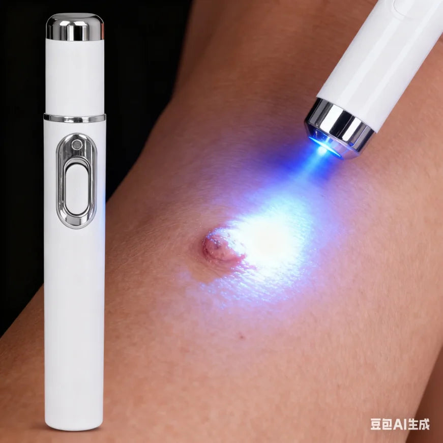 Blue Light Wart Removal Tool - Portable LED Skin Therapy Device Relaxation Treatment Buy 5 Get 5 Free Tidesmit