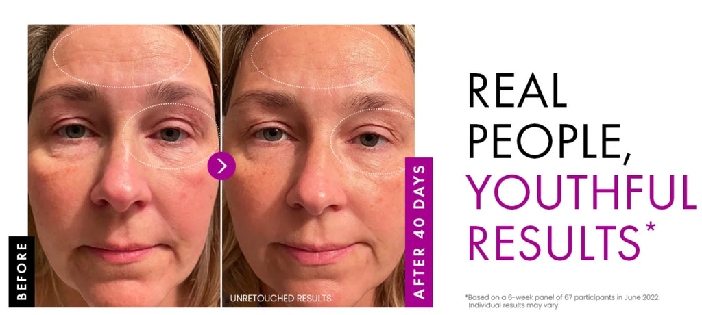 Before and after comparison of a woman's face showing reduced wrinkles and firmer skin after 40 days of cream use.