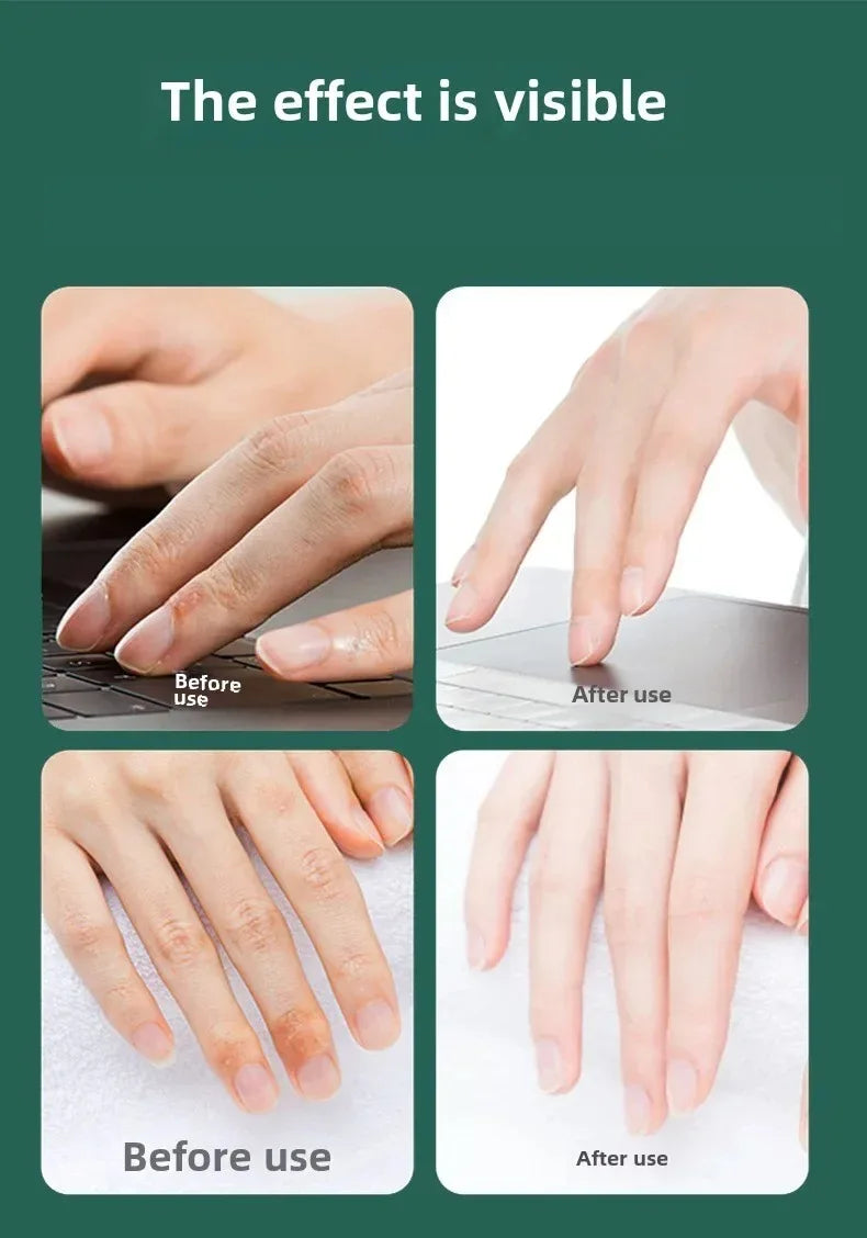 Hand cream for removing wrinkles on finger joints, removing hand wrinkles, and reducing joint roughness and blackness