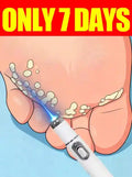 Wart Remover Laser Roller - 7-Day Precision Skin Treatment Tool Massage Roller Buy 10 Get 12 Free Tidesmit