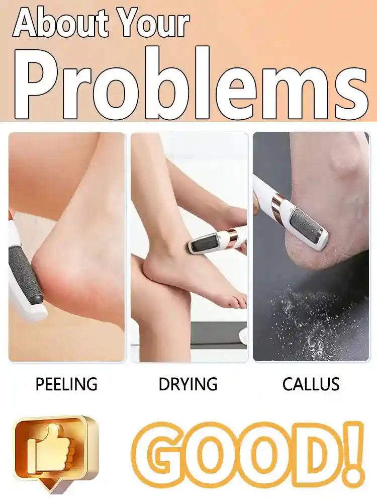 Electric Foot Callus Remover - Rechargeable Skin Exfoliator (White/Pink) Massage Roller Tidesmit
