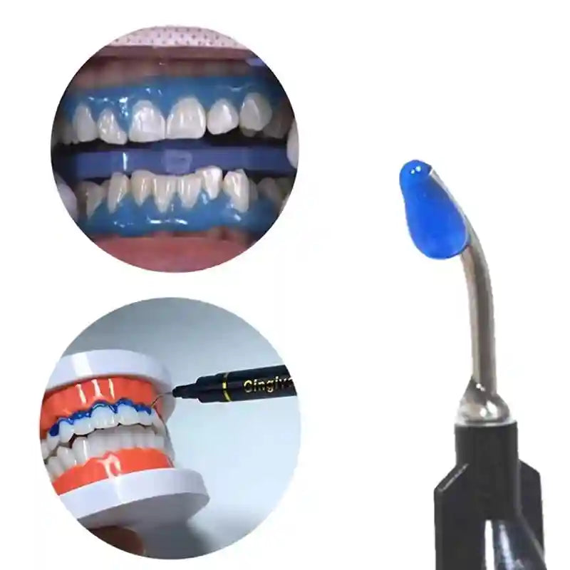 Gingival Barrier Gel for Professional Teeth Whitening - 5PCS Set Lip Care Tidesmit