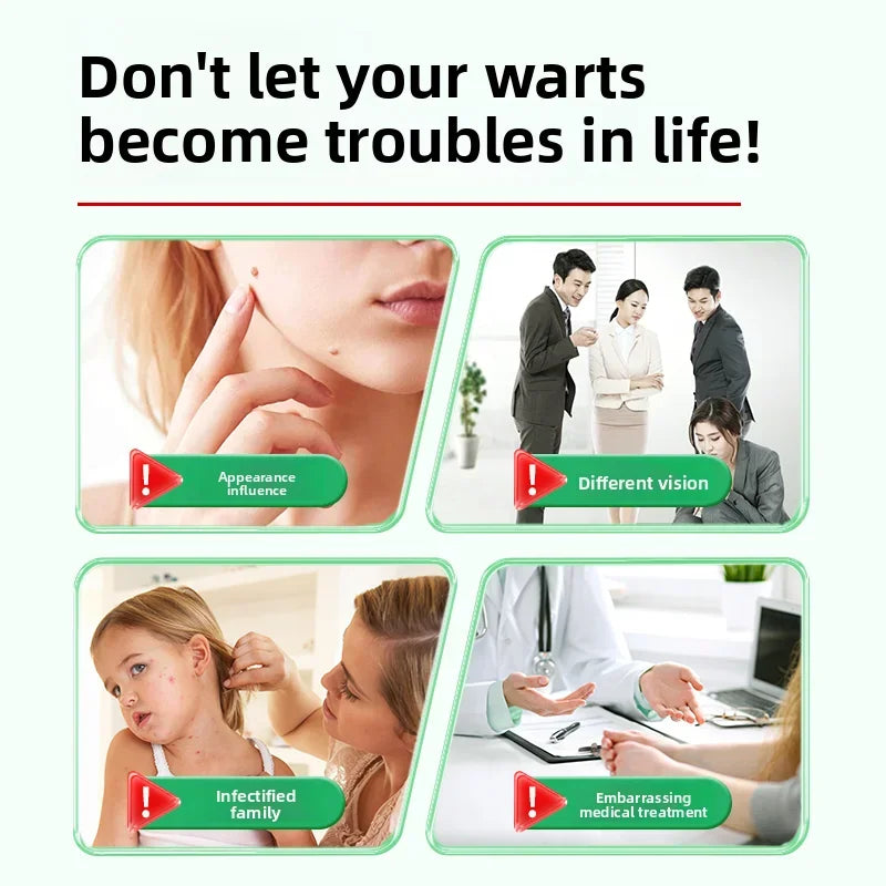 Professional PMU Machine - Precision Skin Tag & Wart Removal Pen Permanent Makeup Machines Tidesmit