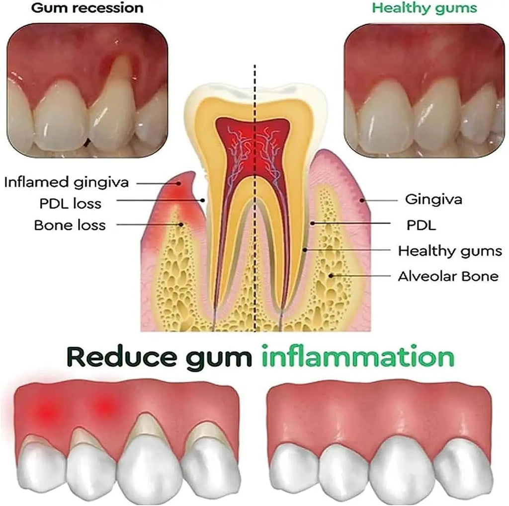 Tidesmit rapid gum repair and teeth whitening serum for damaged enamel and tooth sensitivity relief