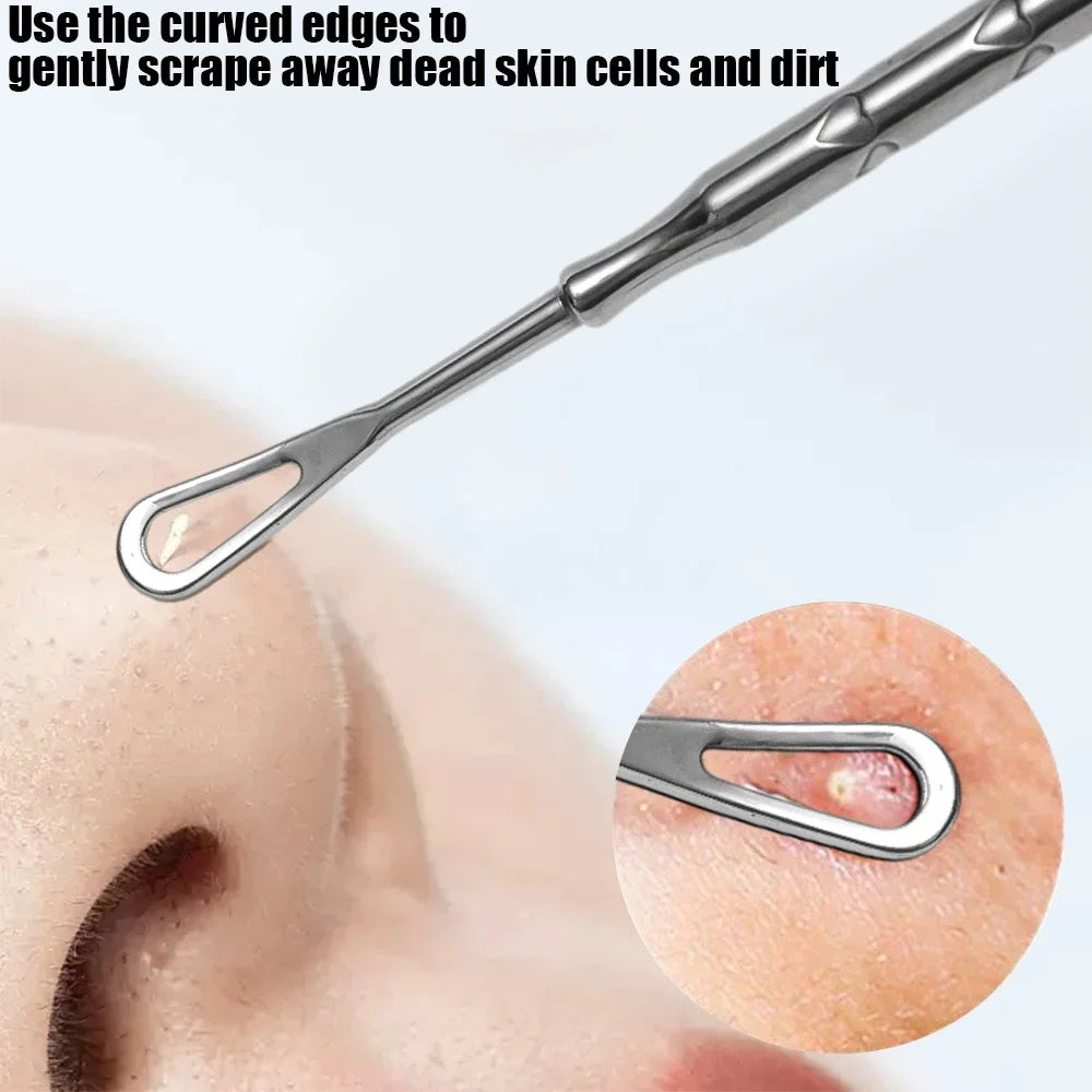 Blackhead Remover Tool Kit 4pc - Professional Stainless Steel Acne Set Scrubs Treatments Tidesmit