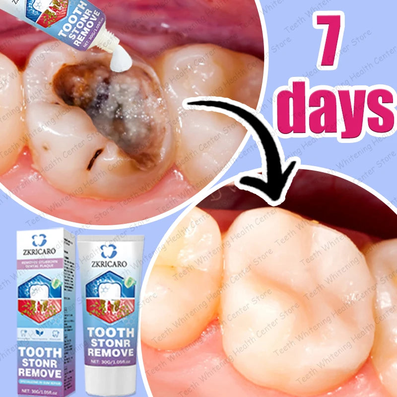 Tooth Decay Repair Treatment | Natural Mineral Enamel Gel | Tidesmit Scrubs Treatments Tidesmit