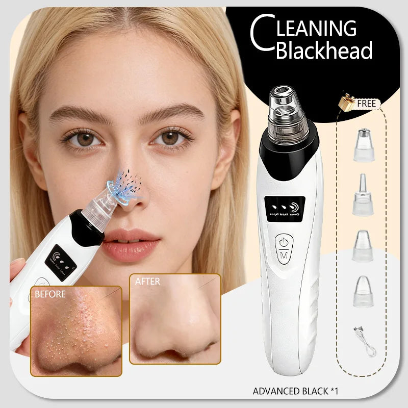 White blackhead vacuum remover tool for deep pore cleansing and pimple removal with four interchangeable heads.