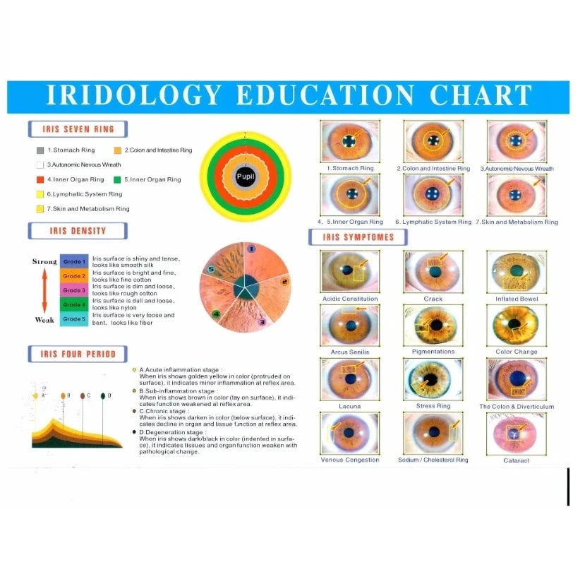 Iridology Digital Camera 12MP Professional Iris Scanner Analyzer Body Shaping Massage Equipment Tidesmit