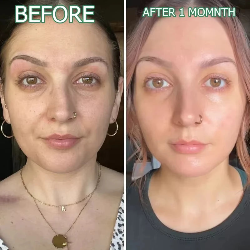 Before and after comparison of a woman's face using skincare, showing smoother, brighter skin after one month.