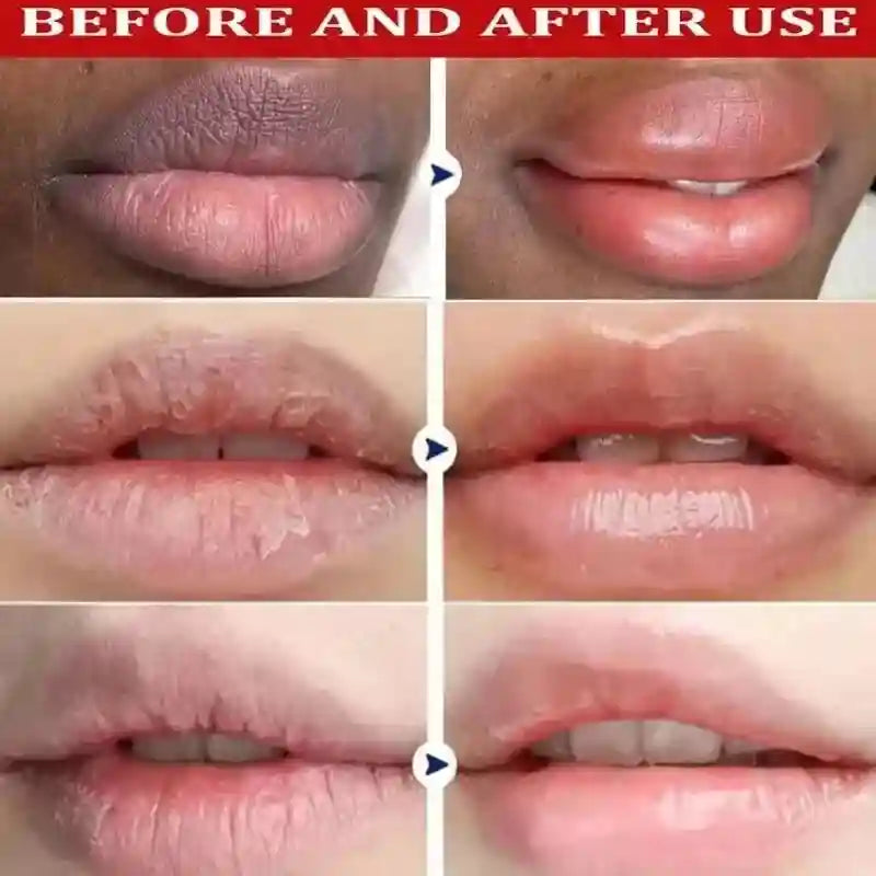 Dark Lip Lightening Serum & Niacinamide Exfoliating Lip Mask Lip Care Tidesmit