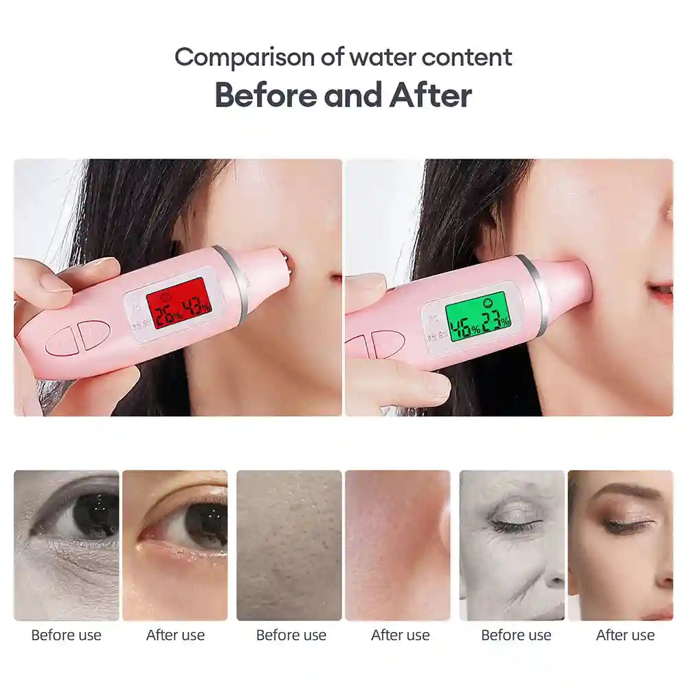 Oxygen Bubble Facial Machine for Deep Skin Cleansing | Tidesmit Eye Massage Instrument Tidesmit