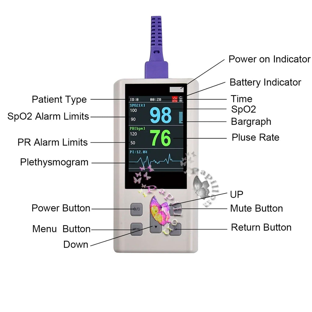 Handheld Pulse Oximeter Veterinary Vital SPO2 PR PI Heart Rate Monitor With Memory Adult Neonatal Pets Hospital Clinic Household