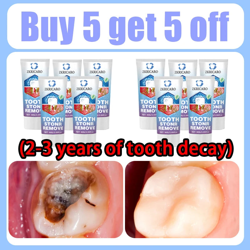 Tooth Decay Repair Treatment | Natural Deep Cleaning & Restorative Formula Scrubs Treatments Buy 5 Get 5 Free Tidesmit