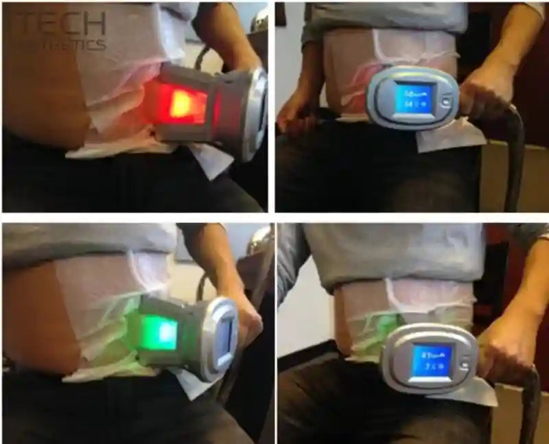 Cryolipolysis Anti-Freeze Membrane Pads 10 PCS (22x24cm, 60G) Fascia Gun Tidesmit