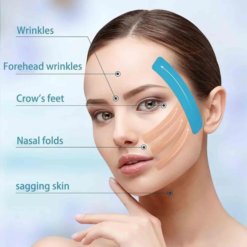 A woman's face shown with blue and skin-colored adhesive tapes applied, labeling targets for skin-tightening treatment.