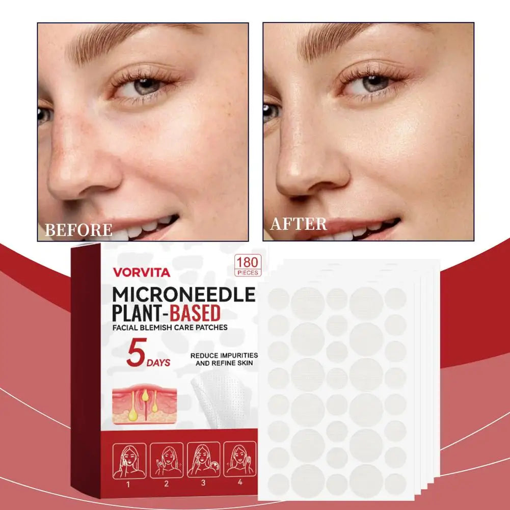 180pcs 0.2mm Facial Soothing Microneedle Patches Acne Care Patch Facial Skin Care Imperfection Patch