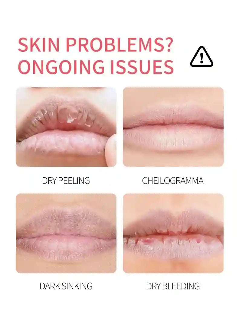 Fruit Lip Balm Set | Moisturizing Lip Care Treatment 8 Pack by Tidesmit Lip Care Tidesmit