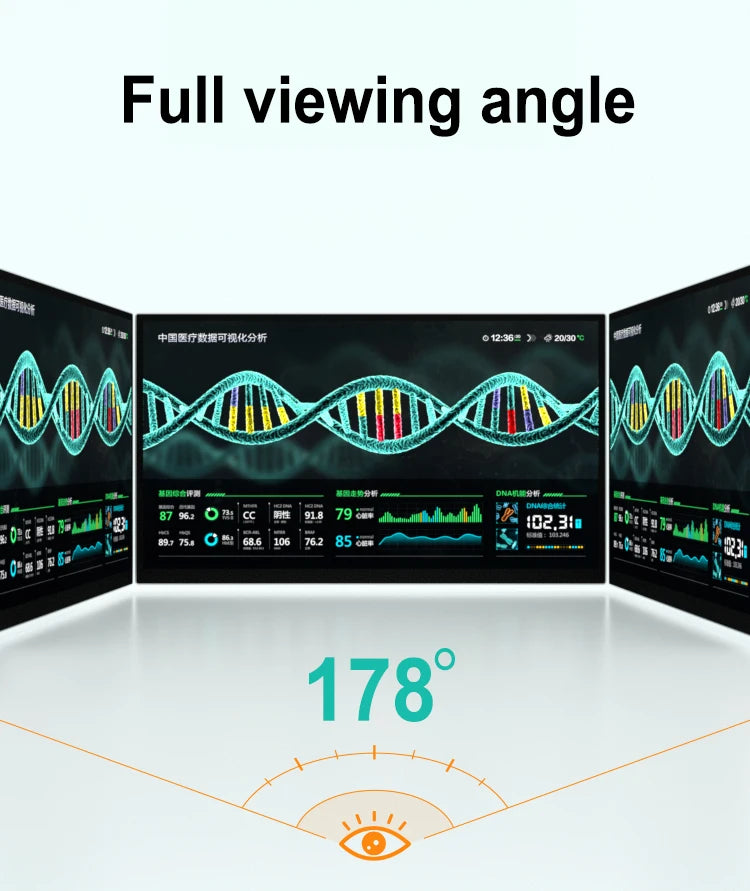VCHANCE 21.5'' Full HD 1080p 100%sRGB Portable Medical Monitor with VESA Mount Display External for Hospital Diagnostic Devices