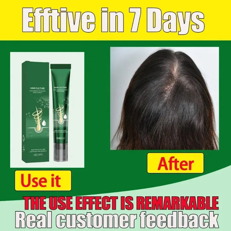 Biotin Hair Growth Oil for Thicker Hair | Natural Scalp Treatment Scrubs Treatments Tidesmit