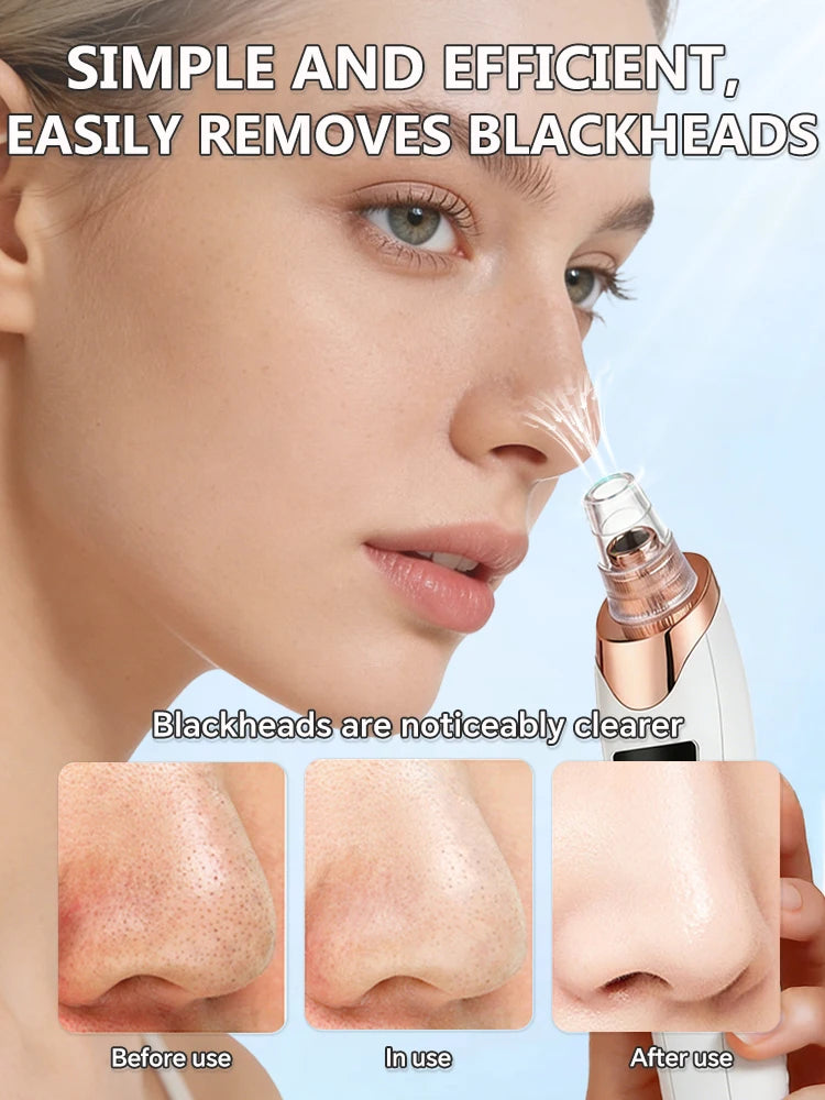 White and rose gold handheld electric facial vacuum used to clear blackheads, shown with before-and-after skin results.